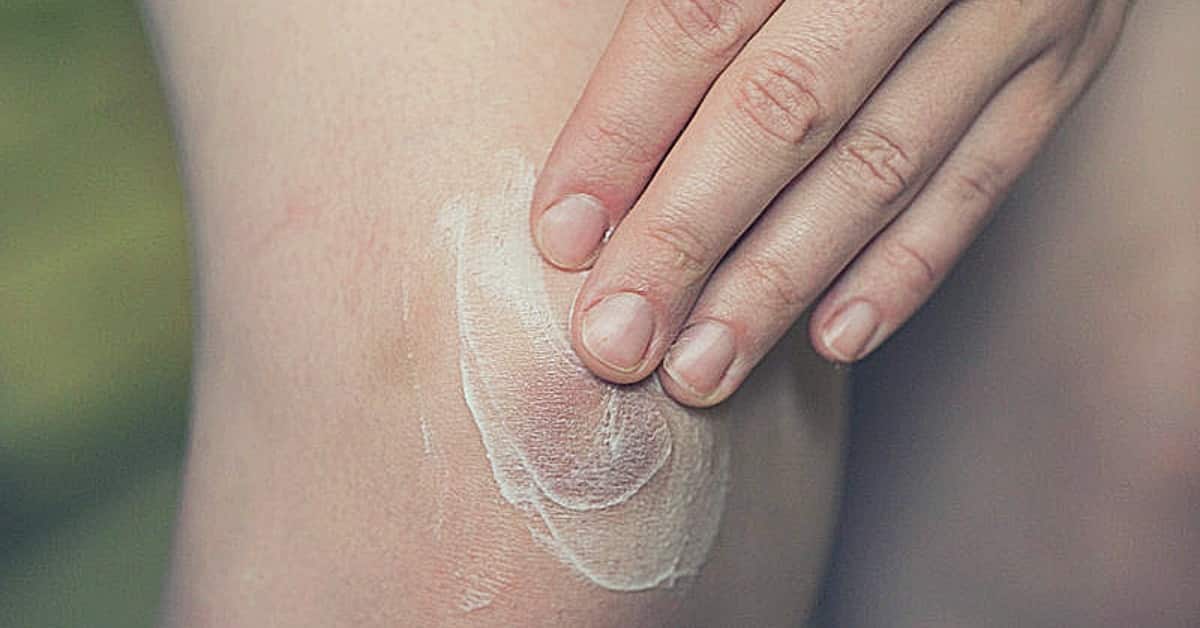 essential oils for bruises