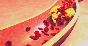 Most Effective Essential Oils For Cholesterol & How To Use Easily!