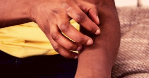 Surprising Essential Oils For Itching Relief & How To Use Effectively!