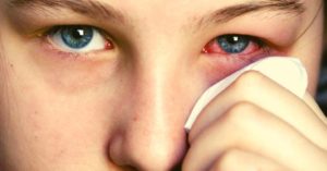 8 Best Essential Oils To Get Rid Of Pink Eye (+3 Recipes & How To Use)