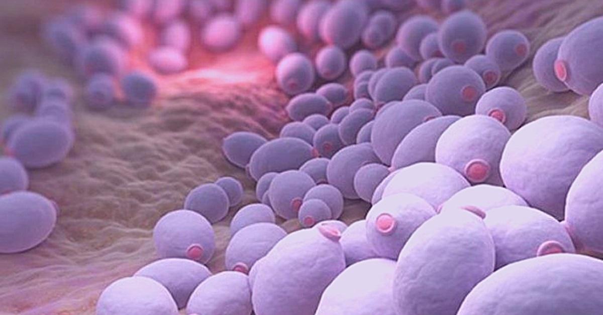 essential oils for yeast infection